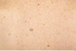 Photo Textures of Human Skin